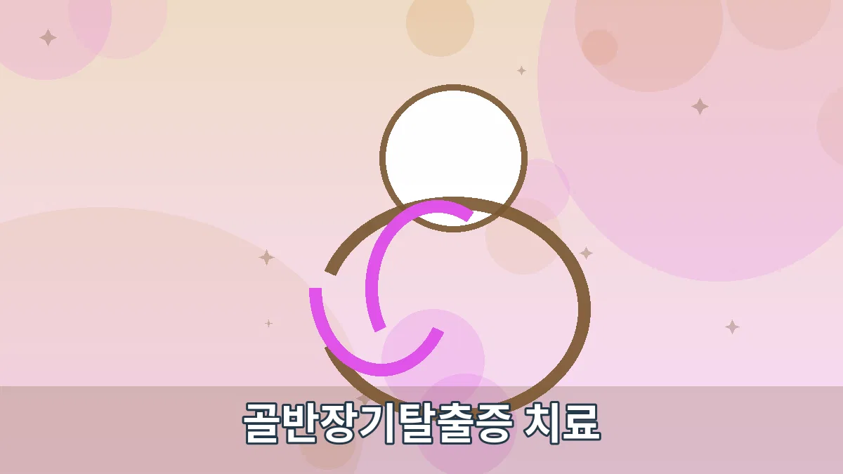 골반장기탈출증 치료 안내 이미지 5